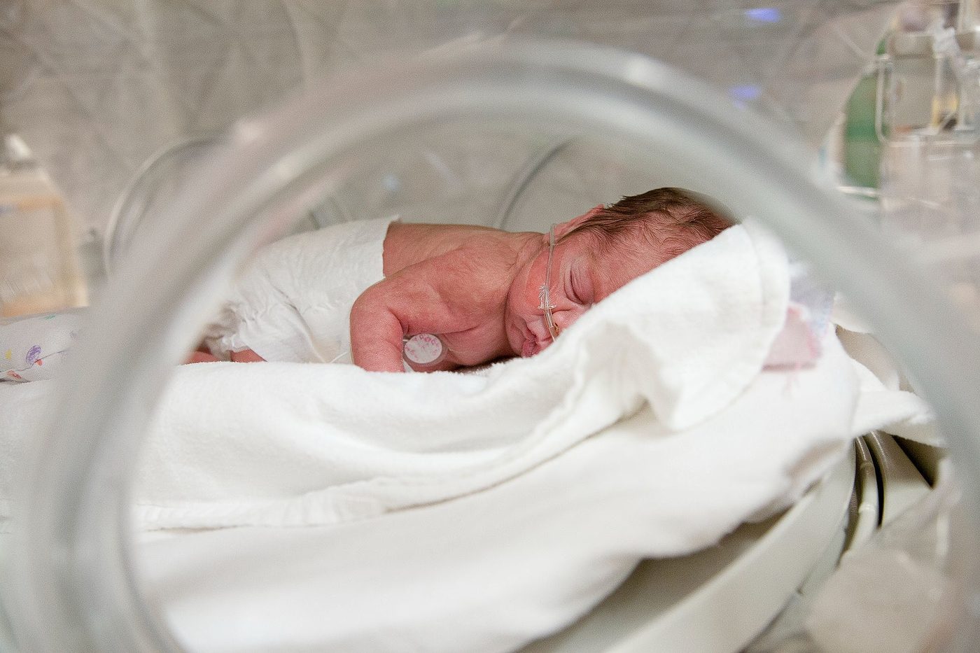 Parto prematuro: O que é, Sinais e Fatores de risco